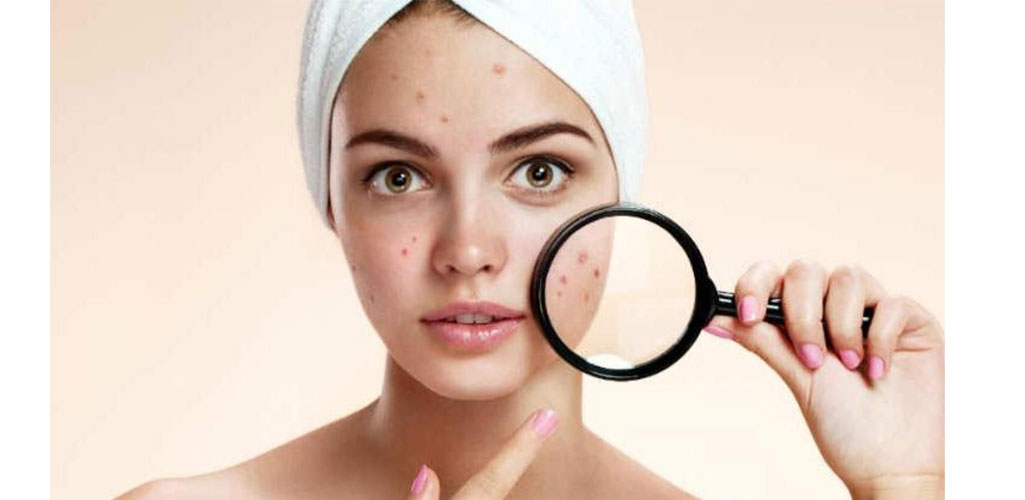 چگونه از شر لک های پوستی خلاص شویم